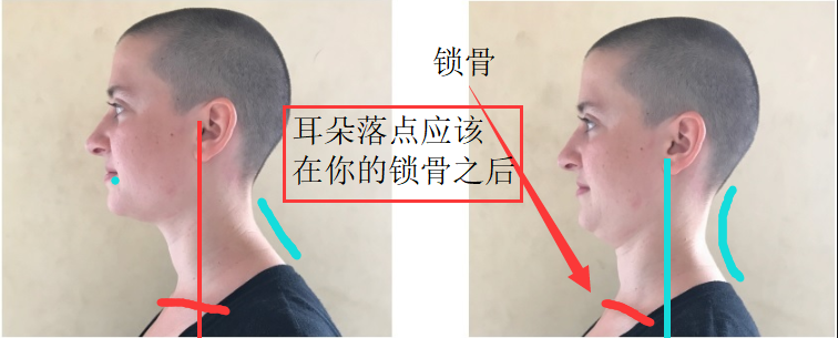 天鹅颈与头前伸驼背 - 知乎