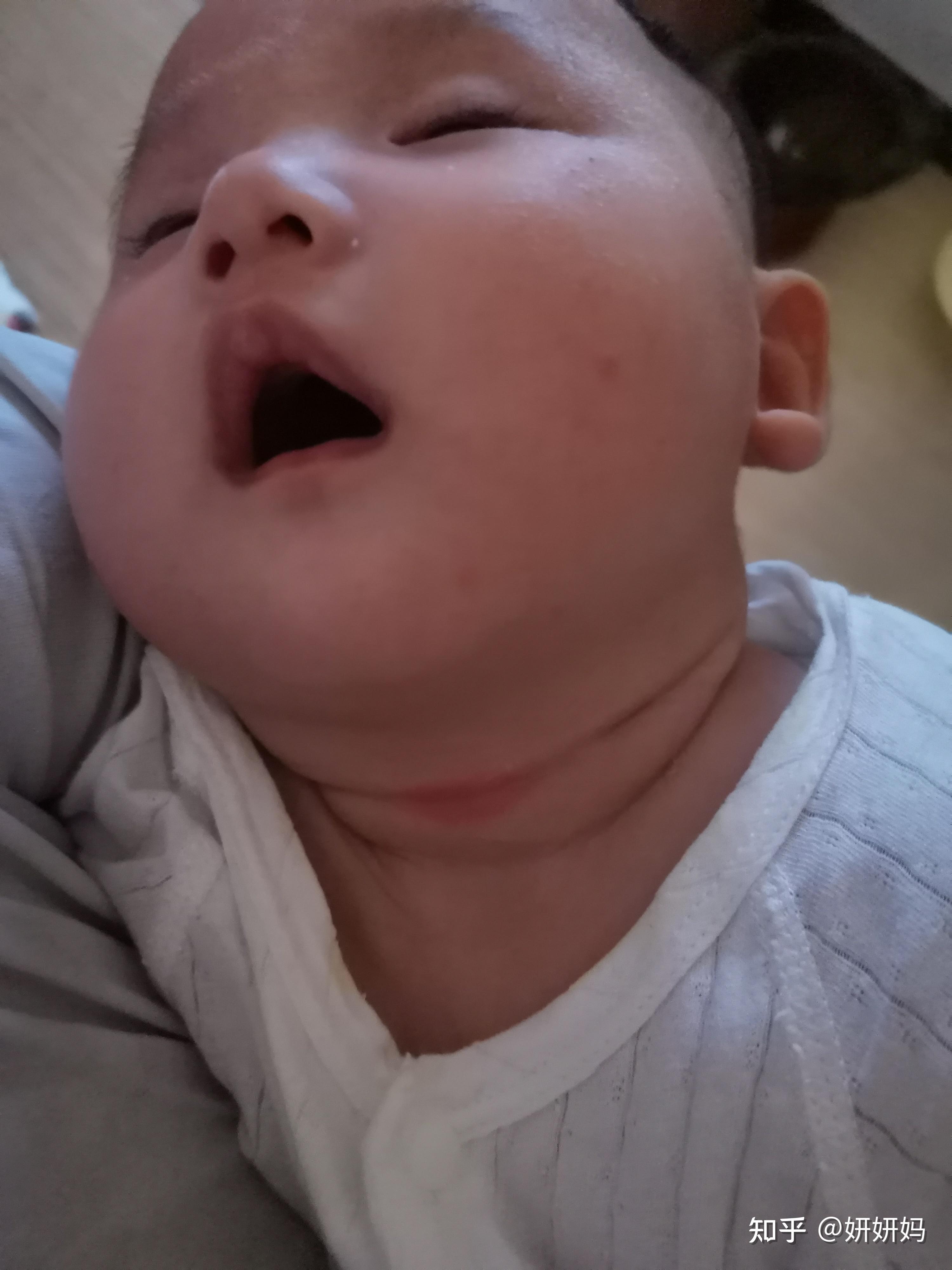 婴儿脖子（新生宝宝这样护理）-幼儿百科-魔术铺