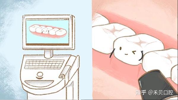 3D齿雕,一招解决三大牙齿问题!! - 知乎