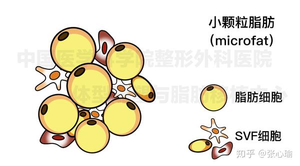 脂肪 | 一张图读懂大颗粒脂肪、小颗粒脂肪、纳米脂肪、脂肪胶的区别 - 知乎