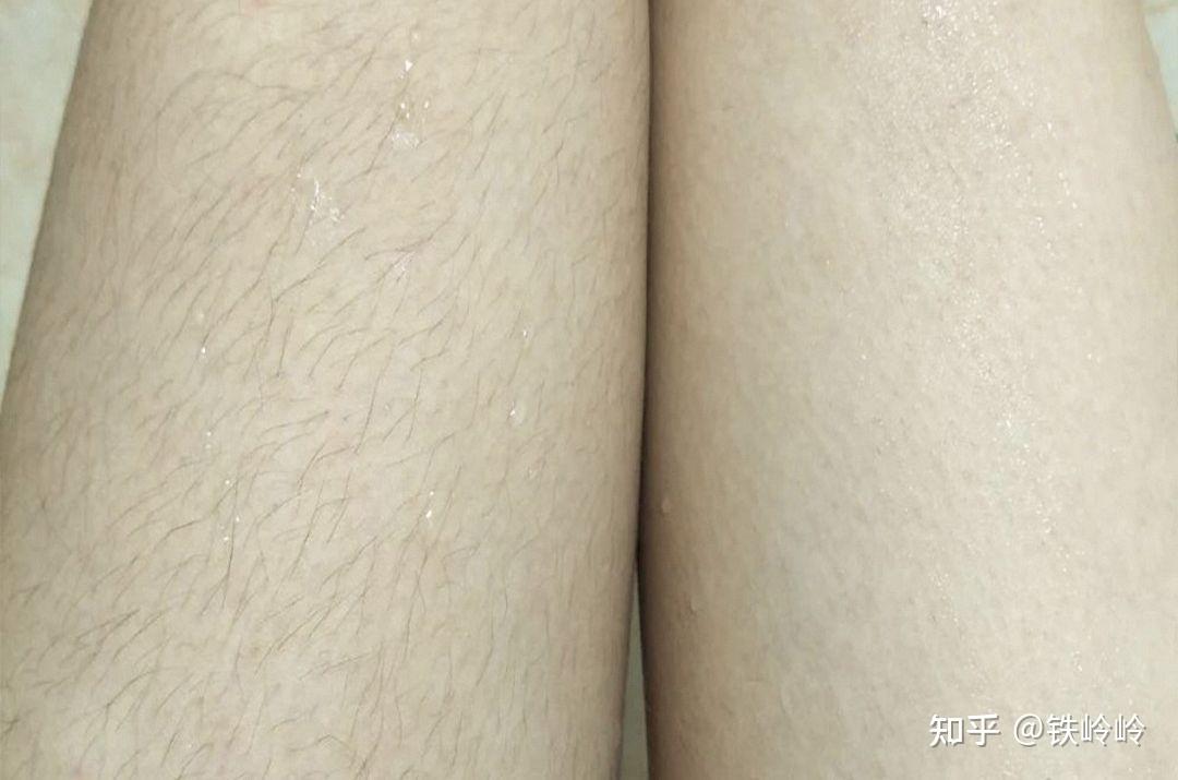 这是我大腿脱完前后(步骤跟刚刚一样哈~)看看我小腿没脱毛的和脱完的