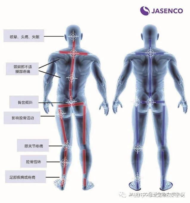 下肢力线示意图图片