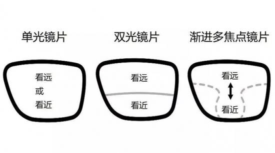 老花镜也有度数美丽岛与年龄有关还需科学验光