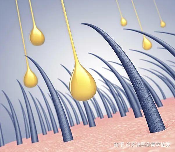 头皮健康，秀发才更闪亮！这些习惯你中招了吗？ - 知乎