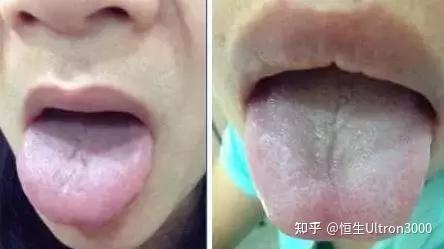 中医总看舌头，都在看什么？九种体质+珍贵的舌诊图谱！ - 知乎