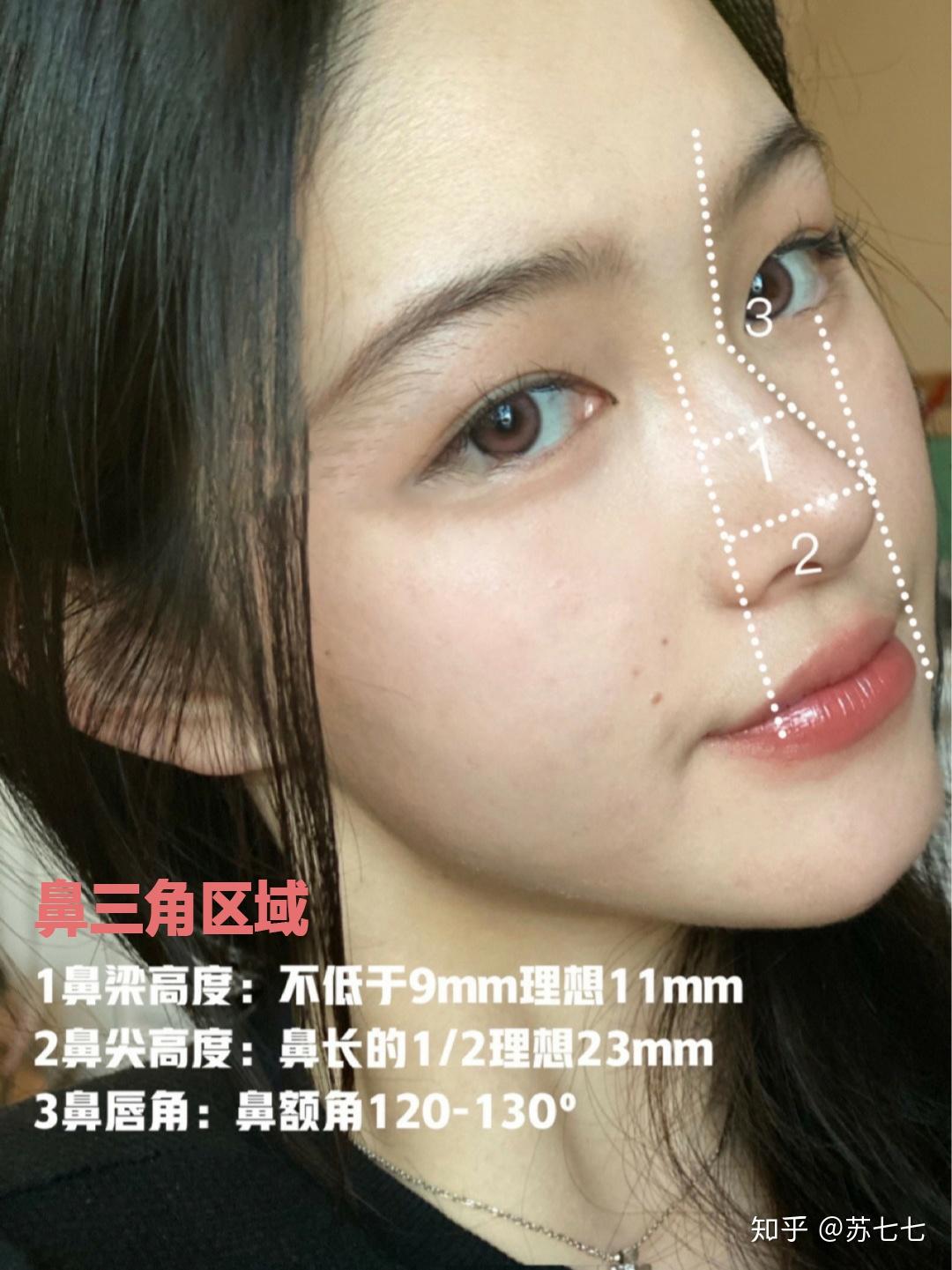 初鼻和鼻修复都千万不能错过的鼻整形模版鼻综合完美鼻型科普文