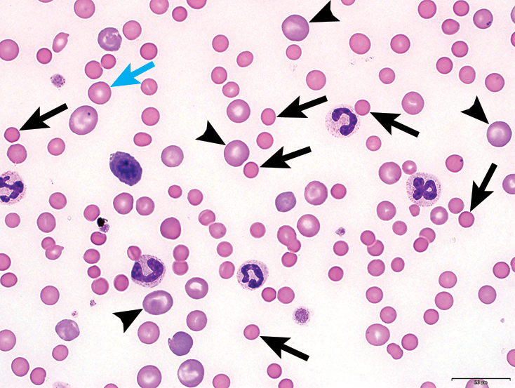 血涂片各种细胞的图片图片