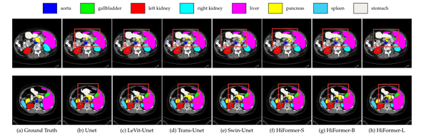 HiFormer: Hierarchical Multi-scale Representations Using Transformers ...