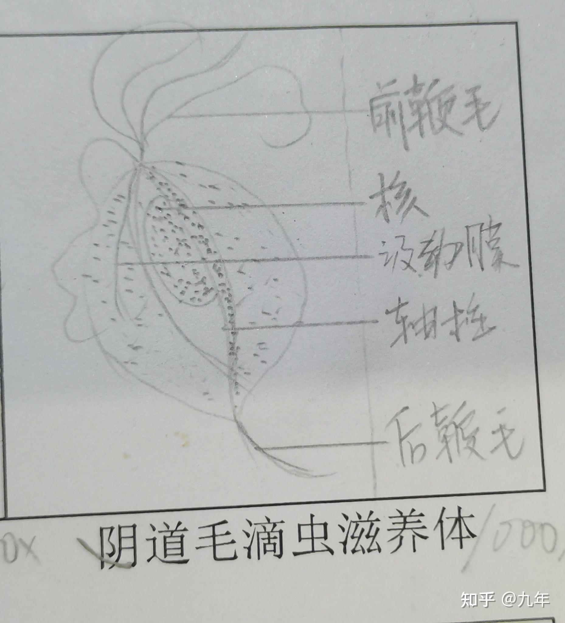 恶性疟原虫铅笔手绘图图片