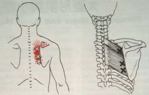 没有久治不愈的病痛 只有一成不变的思路 知乎