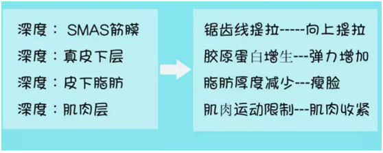 大線一定要穿行在筋膜層才能達到提升的效果,過深過淺都會影響效果,還