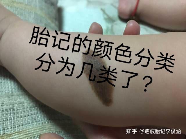 胎记的颜色分类分为几类了?