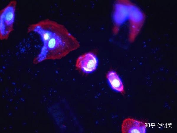 Operata Dapi 显微镜下的肺炎支原体 - 知乎