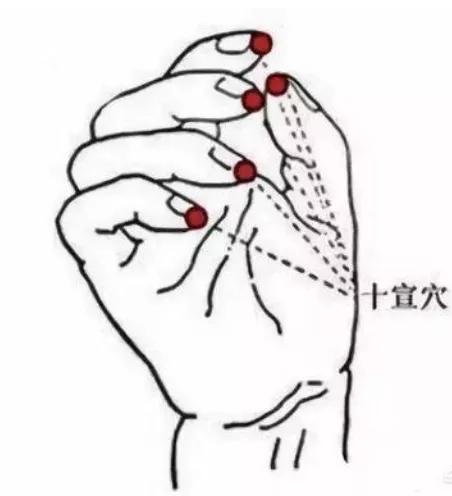 妙手莲华十指放血渡难关这个方法靠谱吗