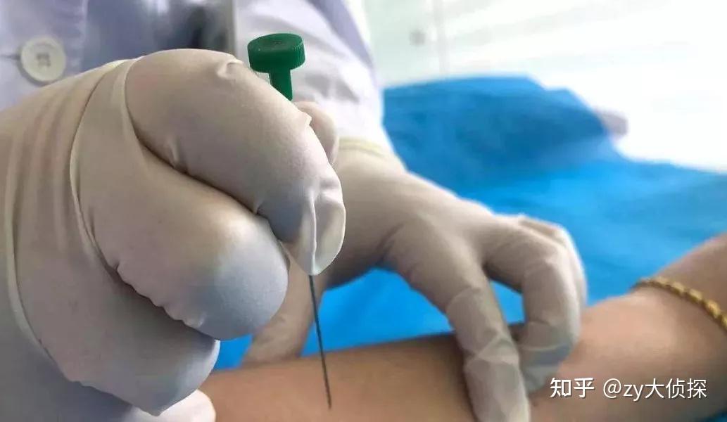 宁夏杨大夫特色针灸穴位埋线疗法强直面瘫都适用