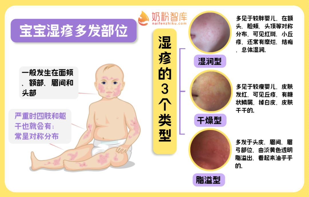 宝宝出疹子了，是湿疹、痱子还是其他皮疹？教你辨别和处理！ - 知乎