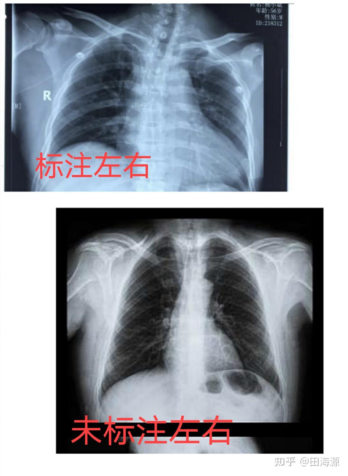 做到这些再也不怕去医院花冤枉钱