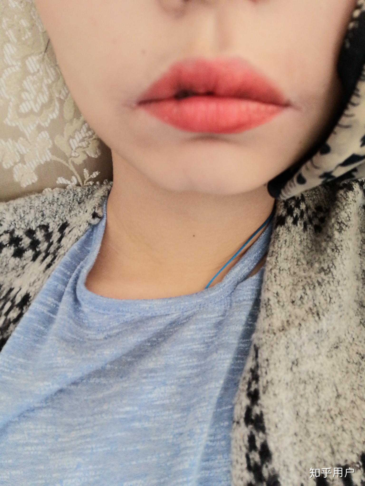 嘴巴难看是一种怎样的体验