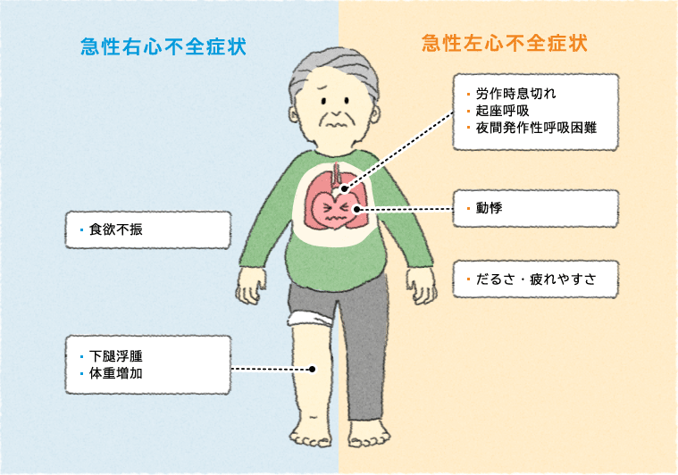 心不全的检查是如何进行的 知乎