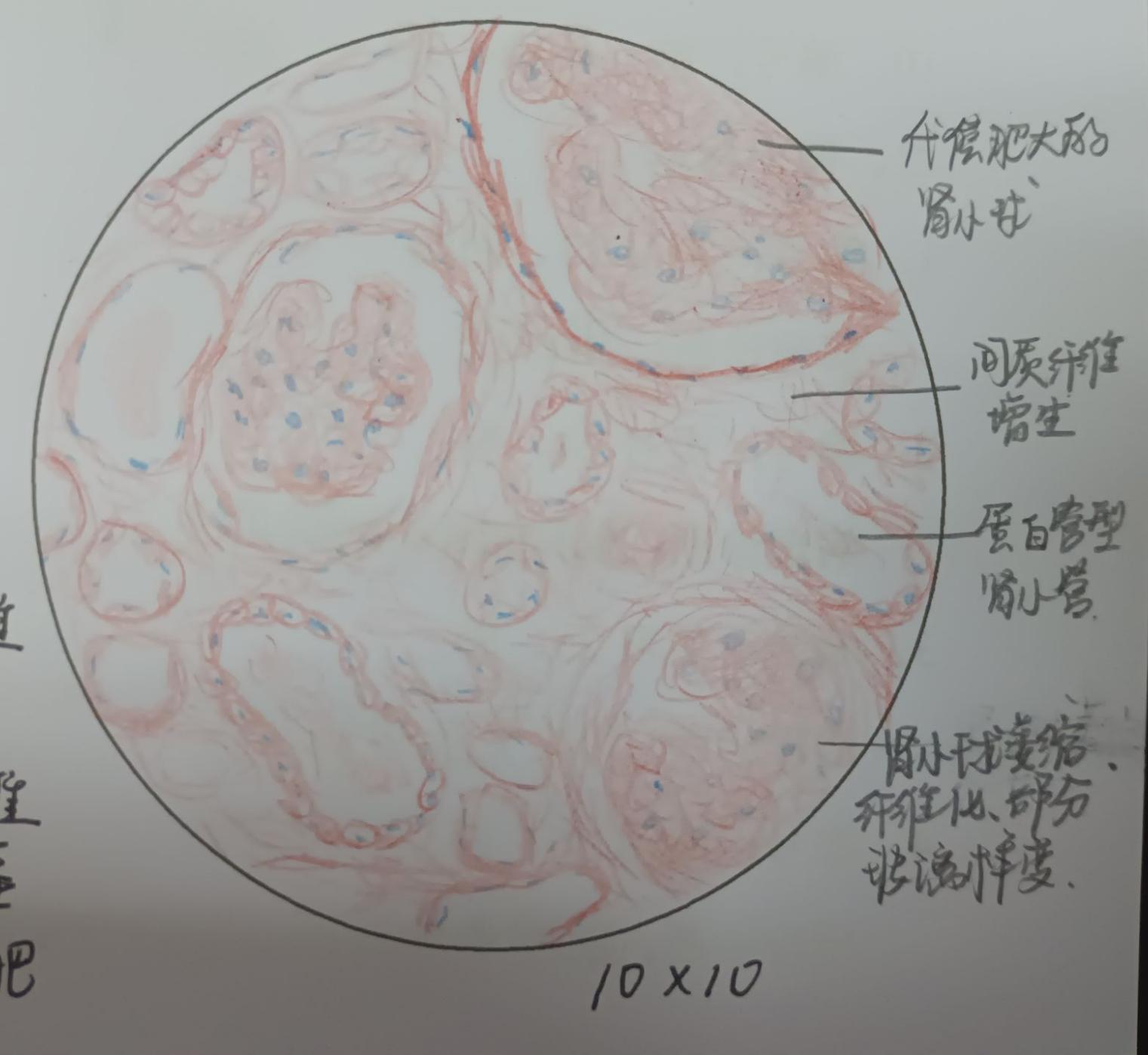 肾小球手绘图图片