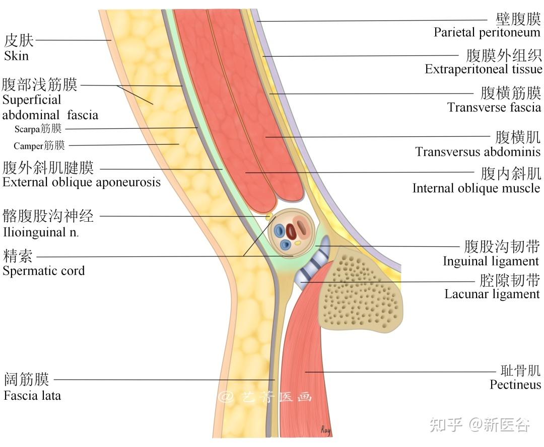 跟谷谷一起看病案学外科《腹股沟疝》(七)——疝修补术大全