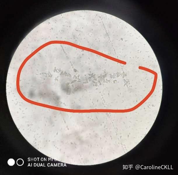 【团子得鸟粪石(膀胱结石)的那些事】-兽医院避雷指南