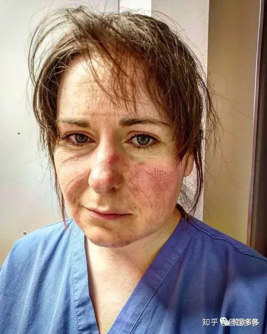 英国疫情防控中的女性