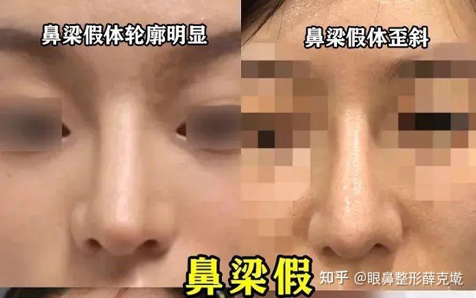 这步没做到位!鼻型怎么看都很假! - 知乎