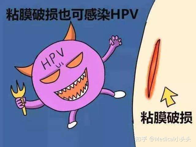 hpv感染的会引起哪几种疾病常见的就这五种