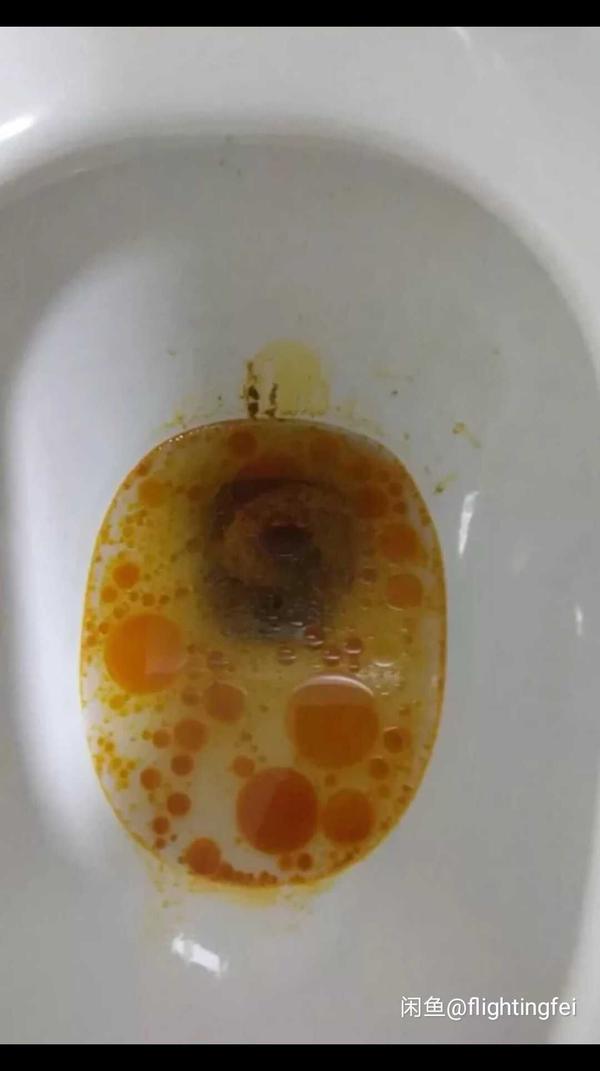 一点都不难,奥利司他 有氧运动,一个月十来斤随便