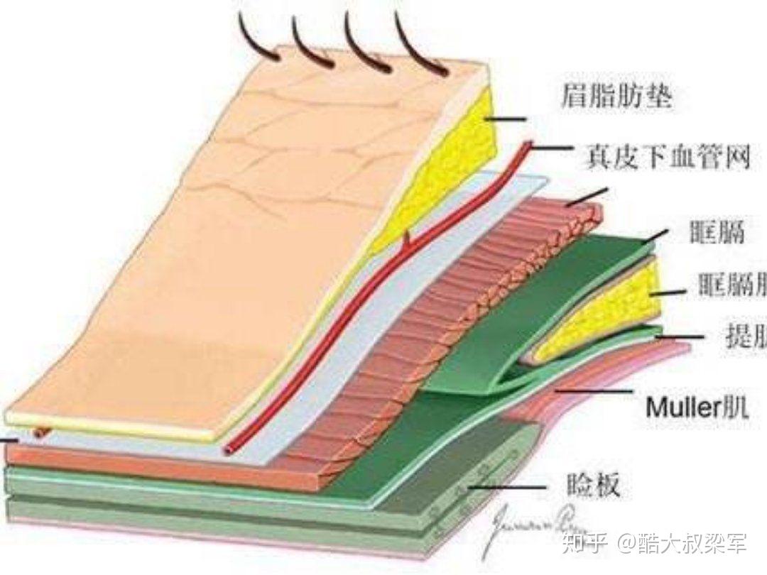 眶隔释放是什么？ - 知乎