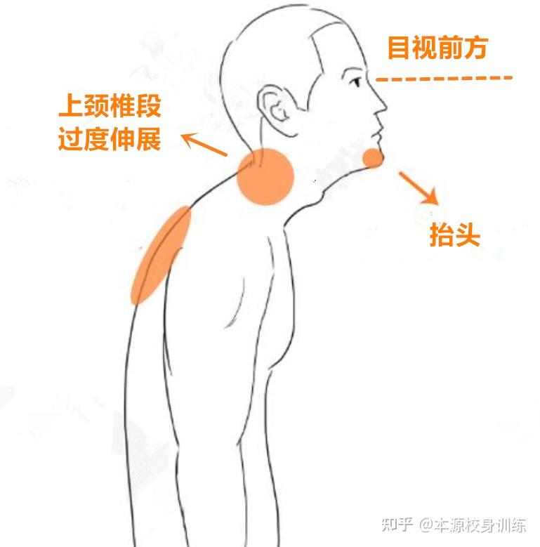 后颈窝长旋的位置图解图片