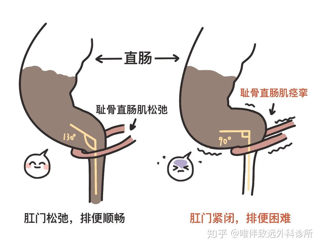 耻骨直肠肌图片