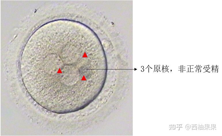 论“以貌取人”这方面还得看我们的胚胎! - 知乎