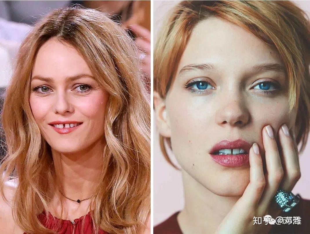 牙缝可以说是法式美女的标志,像"邦女郎"蕾雅·赛杜,德普前女友