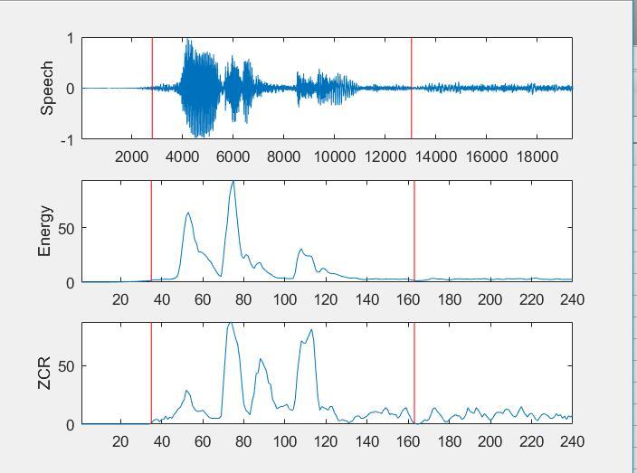 语音信号预处理及特征参数提取