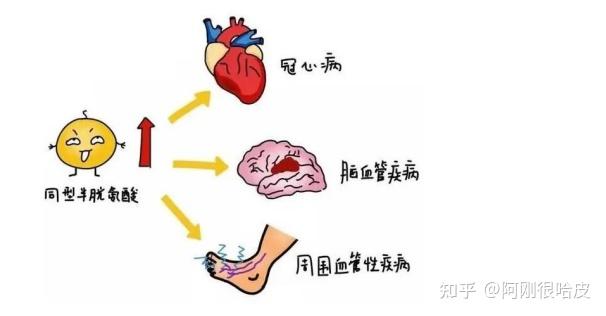 什么是高同血症？健康风险的重要指标！ - 知乎