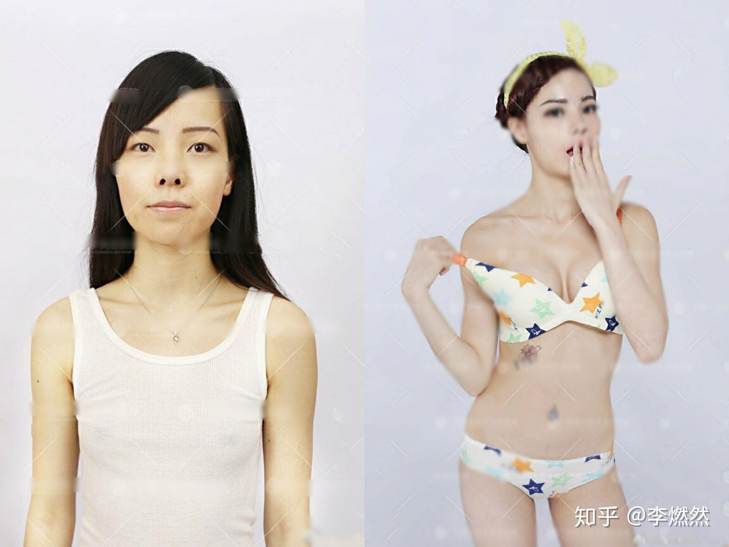 韩娱热议: 做16次隆胸手术挑战最大，44岁女性震惊挑战 - 哔哩哔哩