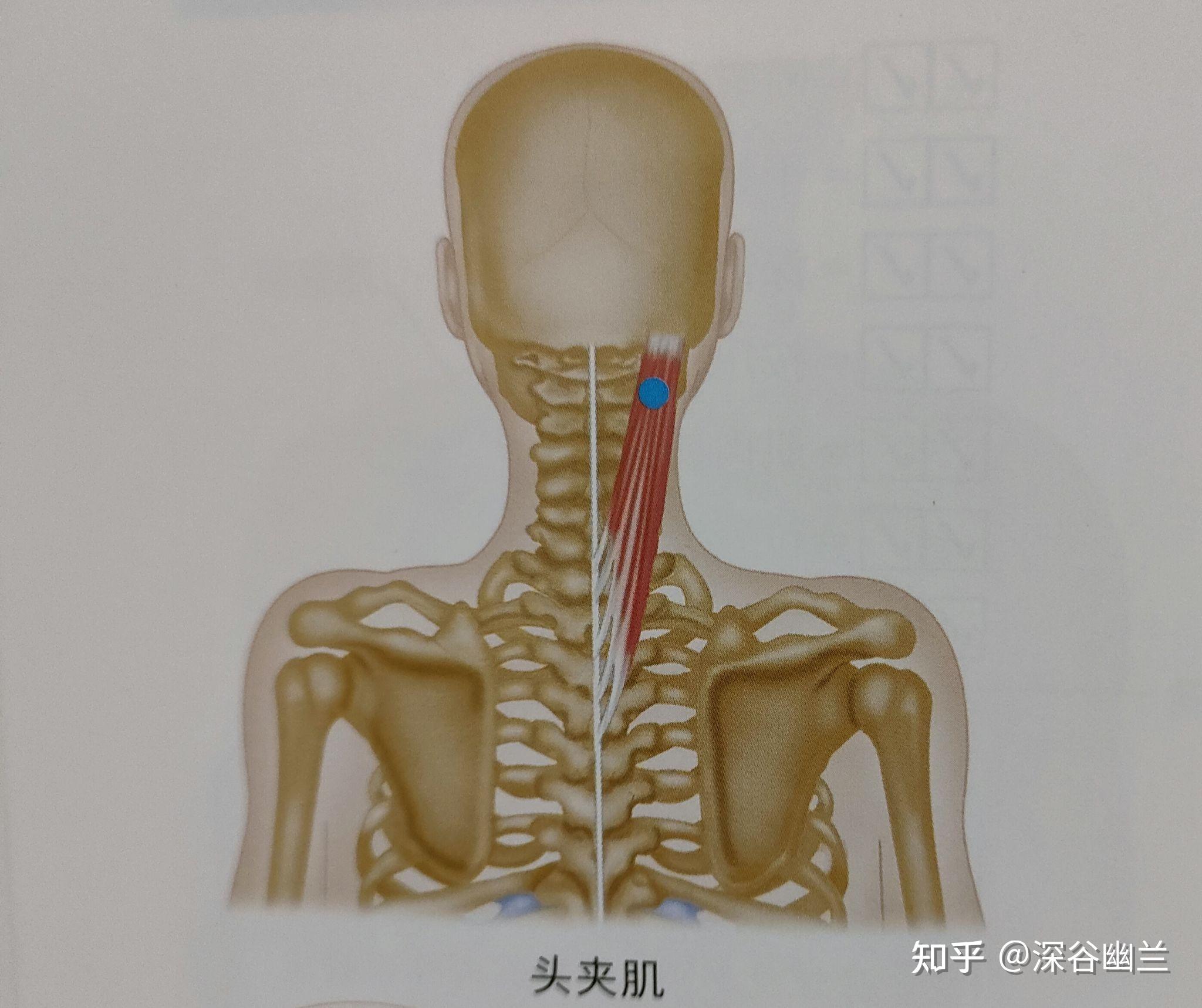 2,頭夾肌激痛點牽涉痛以頭頂為中心的3～5釐米區域.