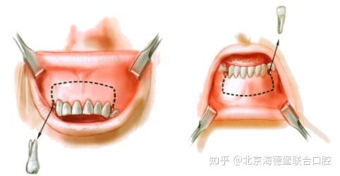v2-cad7be74e0baccca8e57a8bcdaf499ab_r.jpg