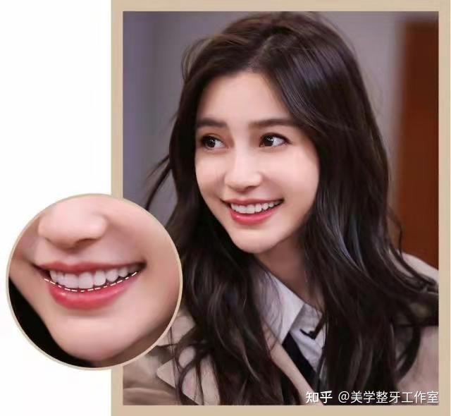 怎么笑才最好看你真的知道吗