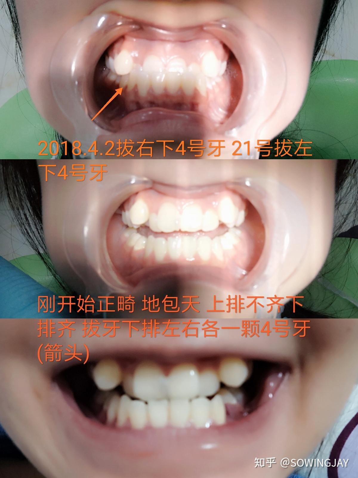 v2-cae35c49bb7b90e9c8d714a83d076c1b_r.jpg