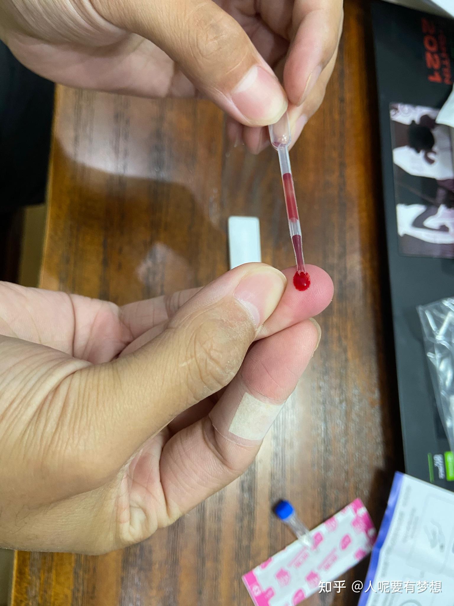 妄想症的朋友们停止你的臆想用酒精棉擦拭准备采血的手指一个采血针