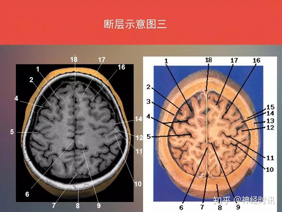 脑功能区及解剖学定位 ( 看到了，你要记得收藏 转发 ) - 知乎