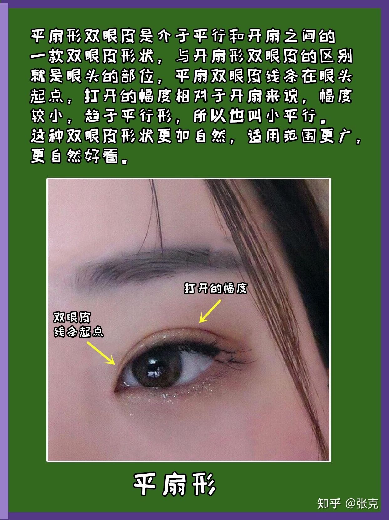 郑州做双眼皮手术方法,翘睫无痕双眼皮_郑州双眼皮医生-站酷ZCOOL
