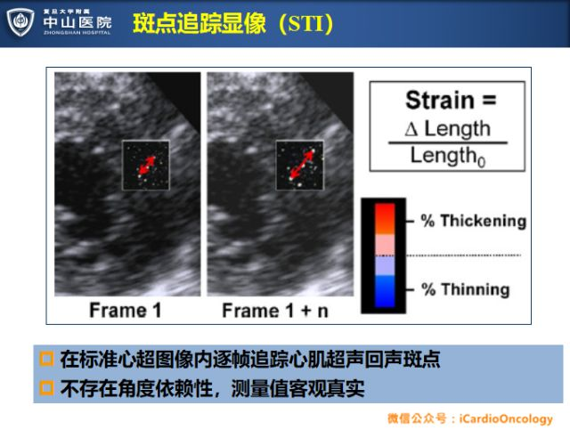 超声三维斑点追踪显像评估淋巴瘤患者蒽环类药物化疗后的心脏毒性