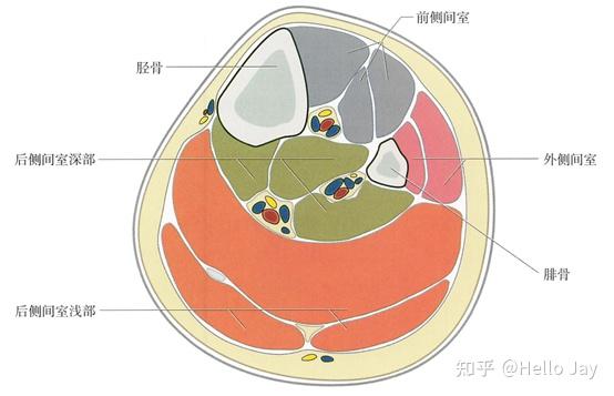 胫骨骨干骨折的治疗原则 知乎