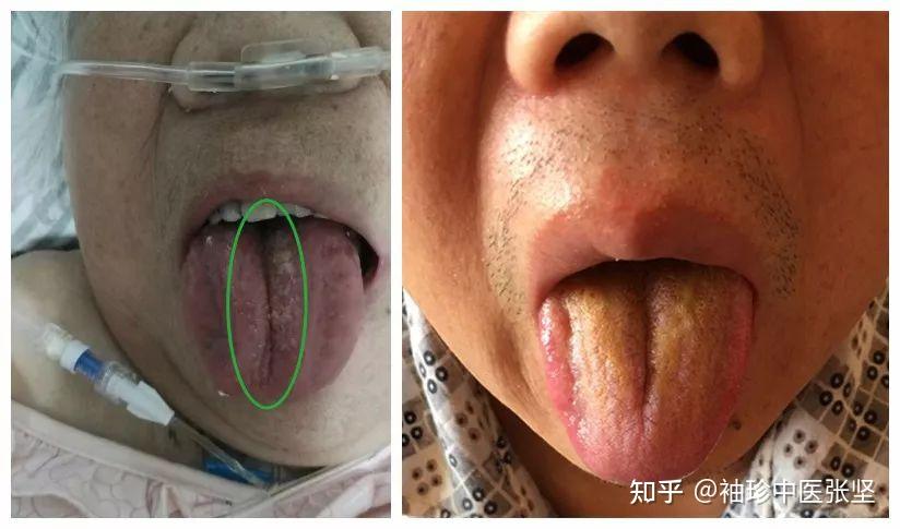 珍贵的舌诊图谱收藏版