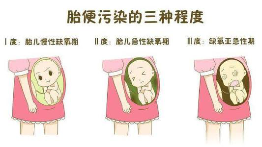 有些胎宝宝,38周以后,会排出少量胎粪,污染羊水,随着孕周变大排出胎粪