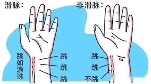 零基础学把脉,想学的进来~ - 知乎